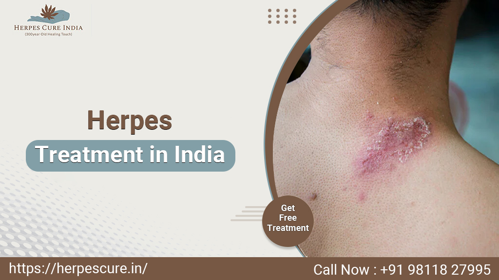 Free Herpes Treatment in India - Ayurvedic Cure for Herpes